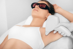 Laser hair removal - treatment area underarms